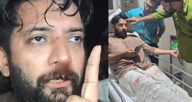 ഷാ​ഫി പ​റ​മ്പി​ലി​ന് പ​രി​ക്കേ​റ്റ സം​ഭ​വം; സം​സ്ഥാ​ന വ്യാ​പ​ക പ്ര​തി​ഷേ​ധ​ത്തി​നൊ​രു​ങ്ങി കോൺഗ്രസ്
